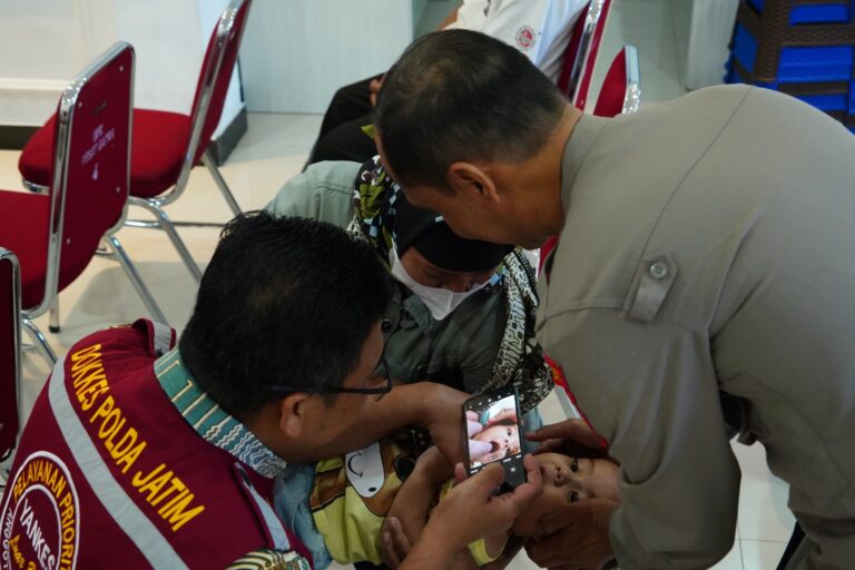 Bakti Kesehatan Polres Ponorogo Gelar Screening Katarak dan Bibir Sumbing
