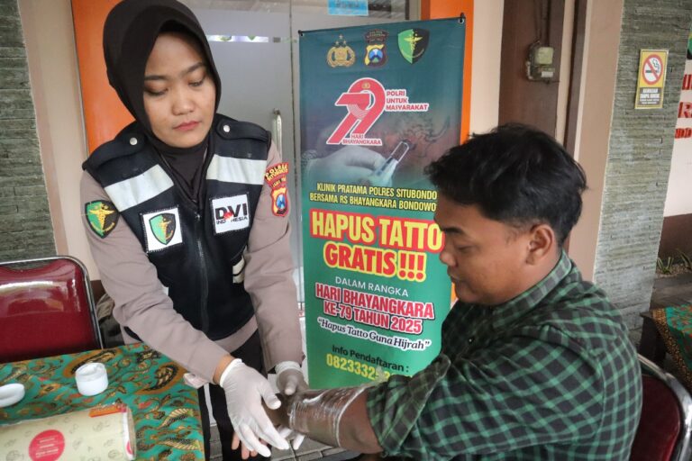 Polres Situbondo Beri Layanan Hapus Tato Gratis di Hari Bhayangkara ke-79
